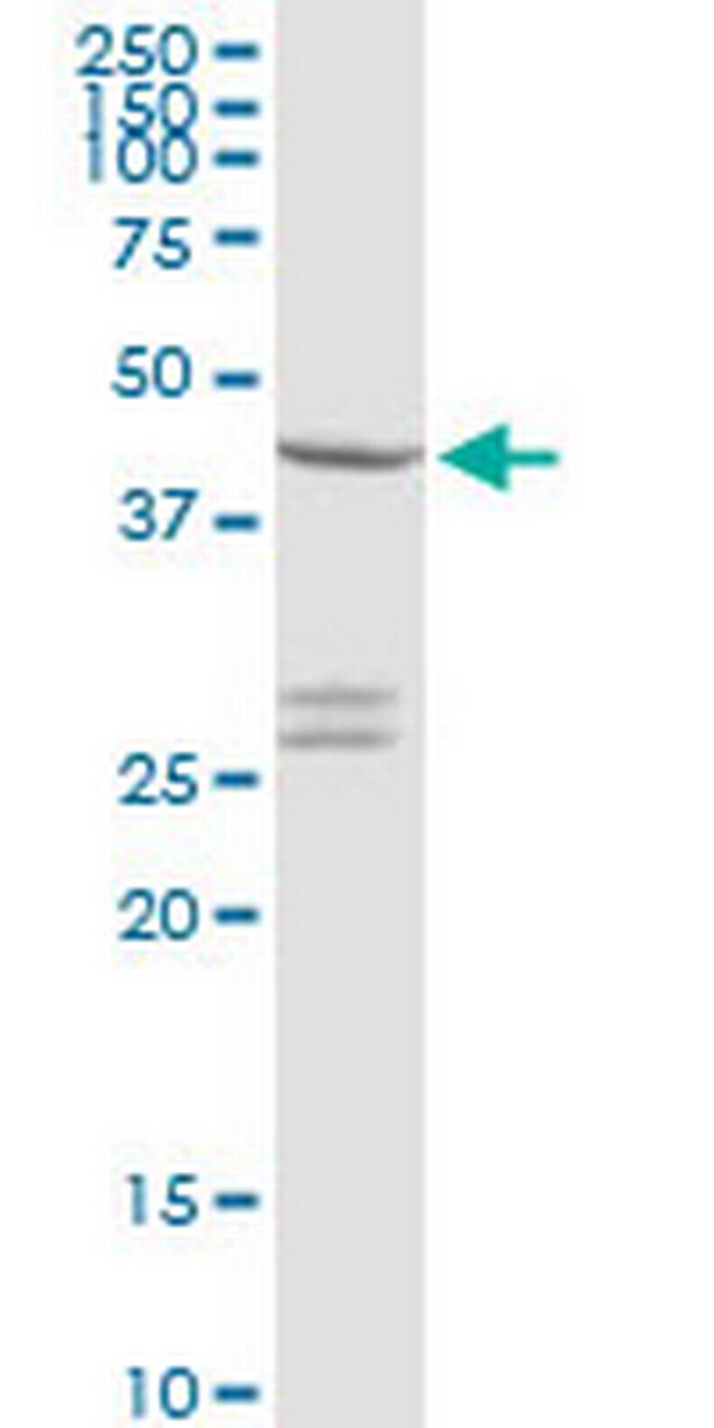 CXADR Antibody in Western Blot (WB)