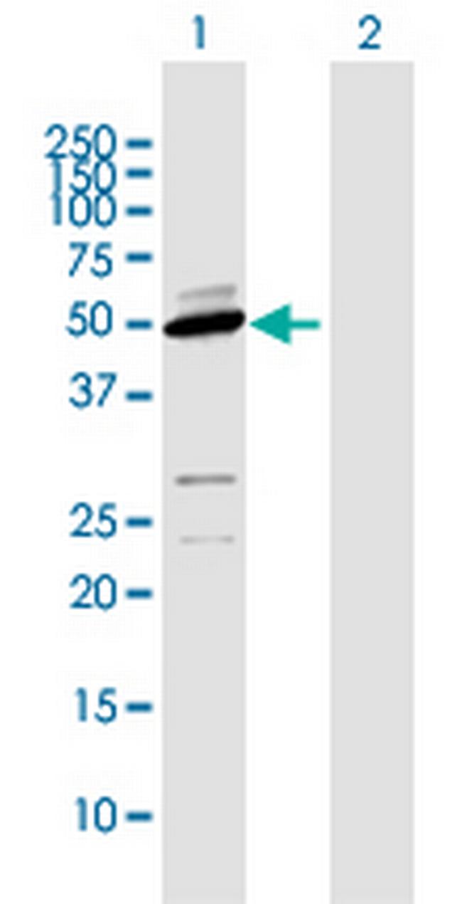 CYP2D6 Antibody in Western Blot (WB)