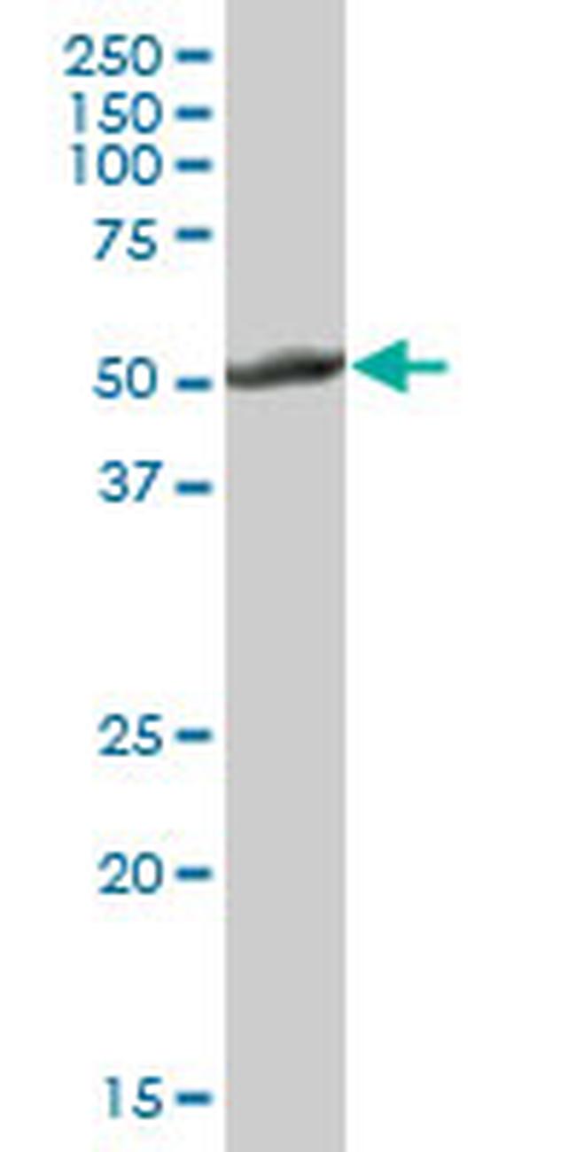 CYP2E1 Antibody in Western Blot (WB)