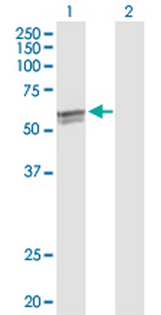 CYP27A1 Antibody in Western Blot (WB)