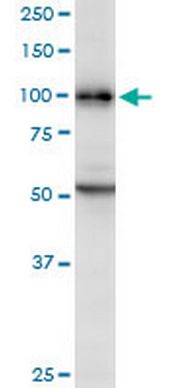 DAB2 Antibody in Western Blot (WB)