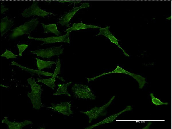 DAF Antibody in Immunocytochemistry (ICC/IF)