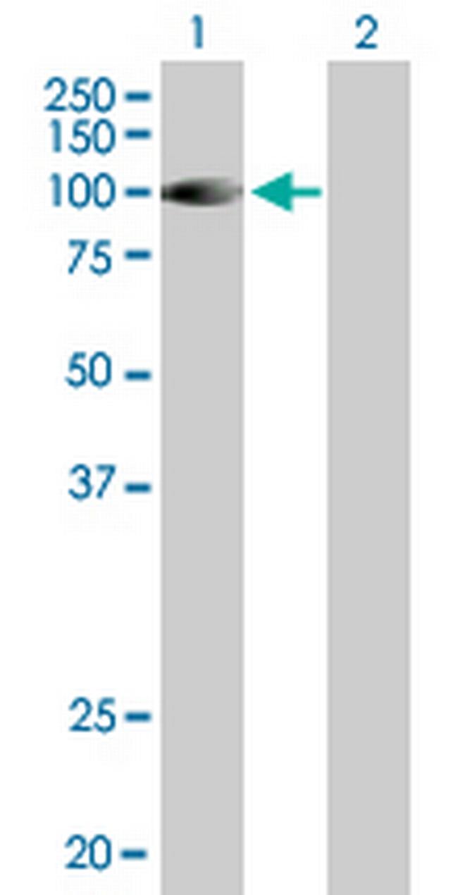 DGKG Antibody in Western Blot (WB)