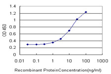 DARS Antibody in ELISA (ELISA)