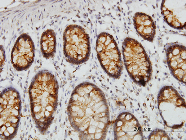 DARS Antibody in Immunohistochemistry (Paraffin) (IHC (P))