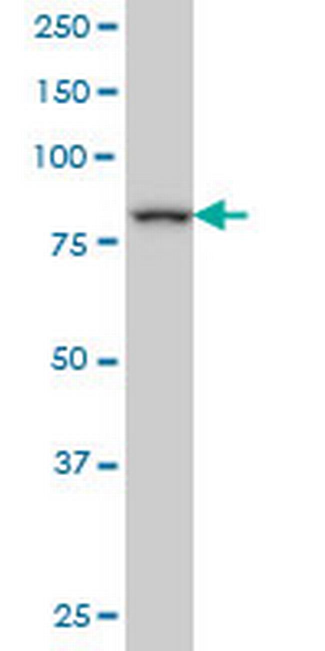 DAZ1 Antibody in Western Blot (WB)