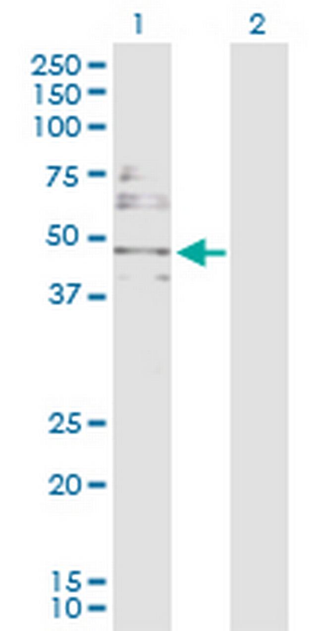 DBC1 Antibody in Western Blot (WB)