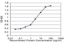 DBN1 Antibody in ELISA (ELISA)