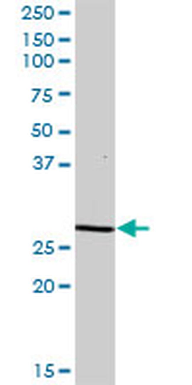 DCI Antibody in Western Blot (WB)