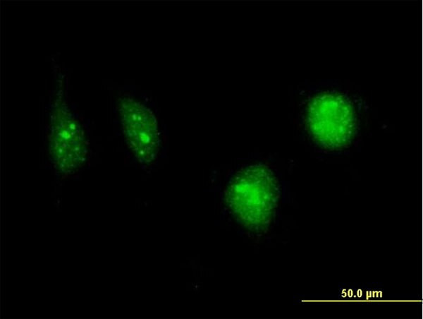 DCK Antibody in Immunocytochemistry (ICC/IF)