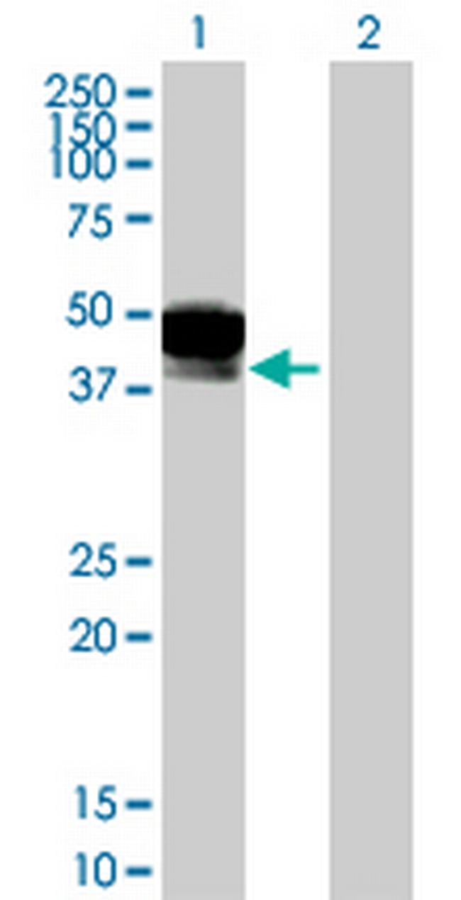 DCN Antibody in Western Blot (WB)