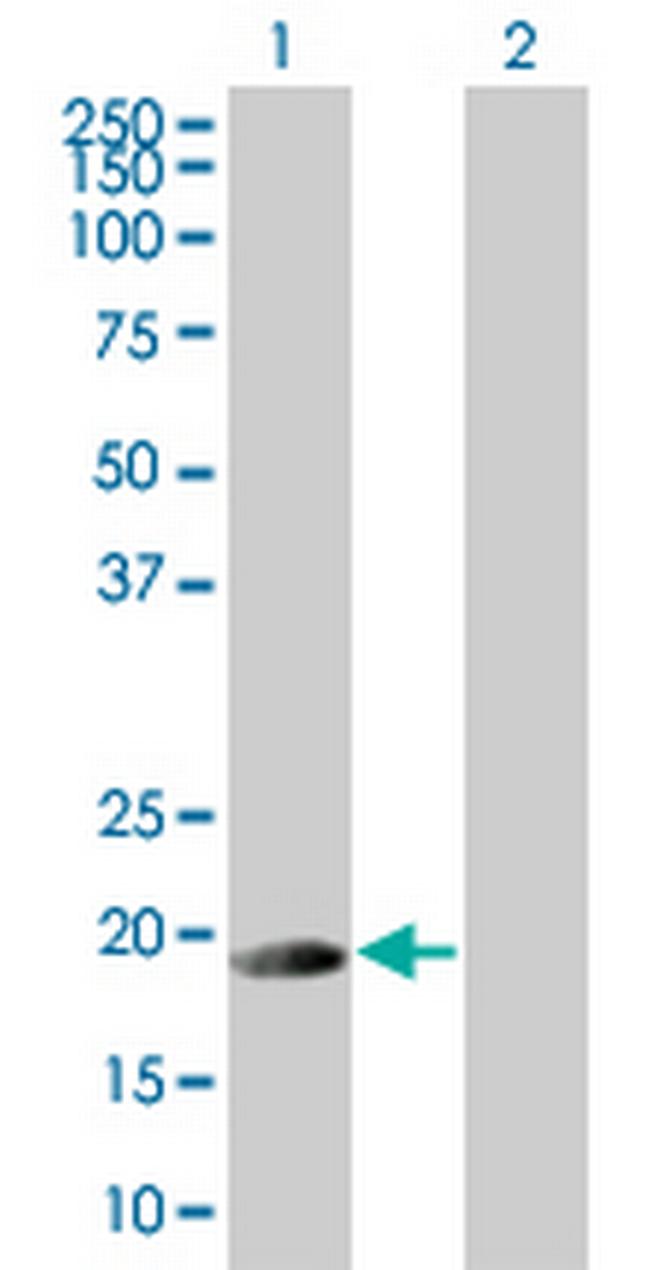 DCTD Antibody in Western Blot (WB)