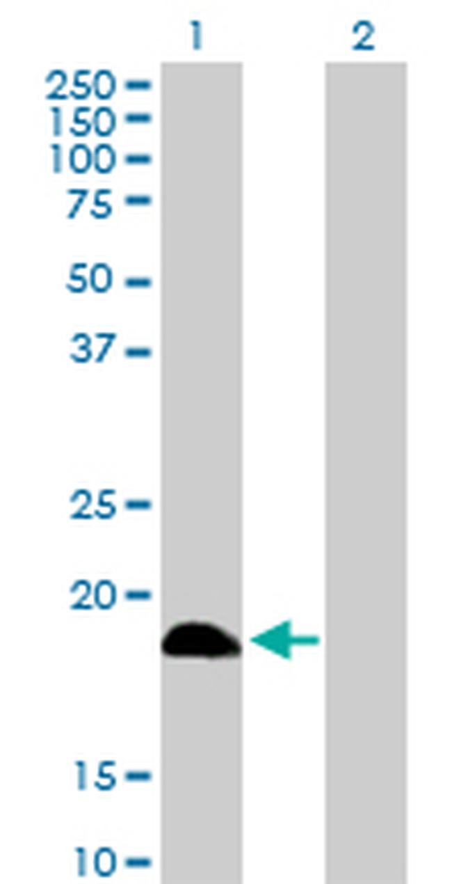 DCTD Antibody in Western Blot (WB)