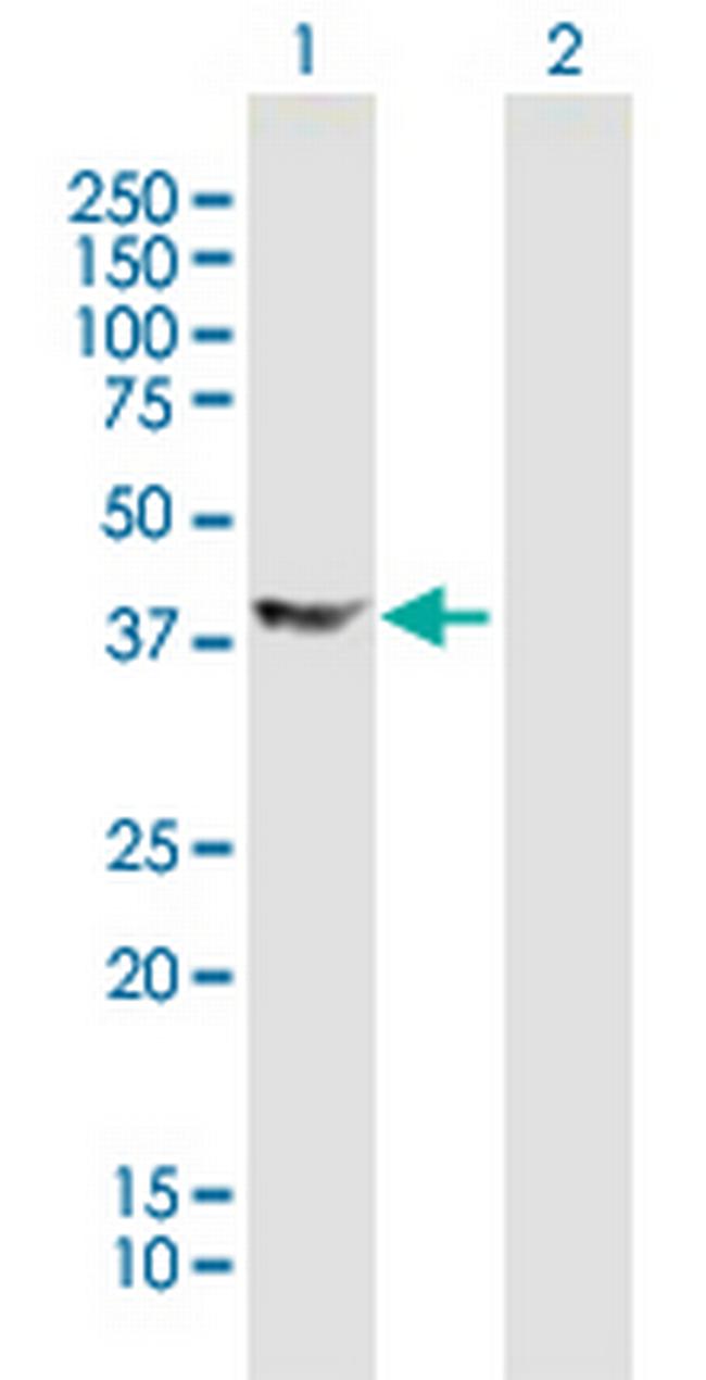 DCX Antibody in Western Blot (WB)