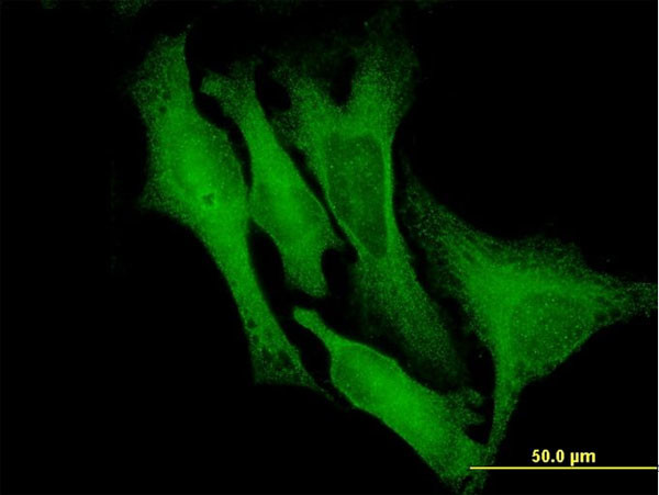 DCX Antibody in Immunocytochemistry (ICC/IF)