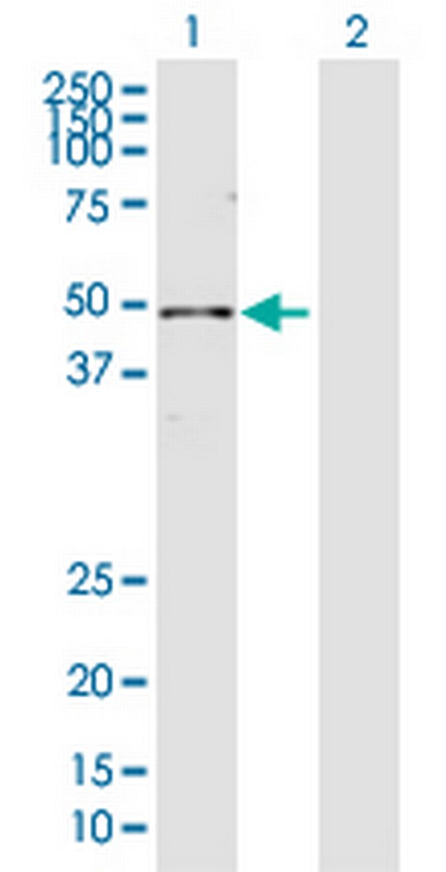 DDB2 Antibody in Western Blot (WB)