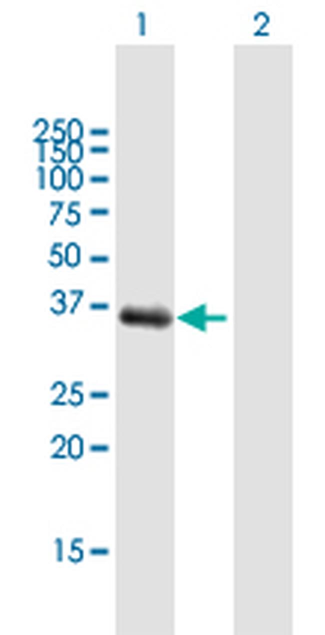 AKR1C1 Antibody in Western Blot (WB)