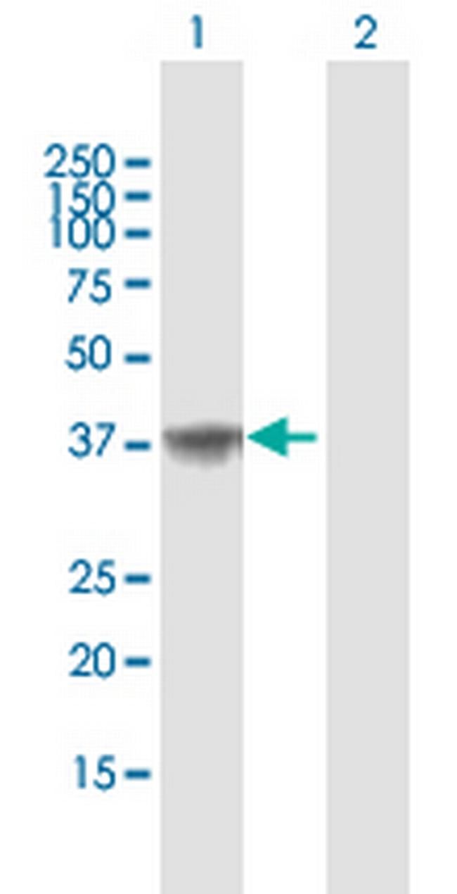 AKR1C2 Antibody in Western Blot (WB)