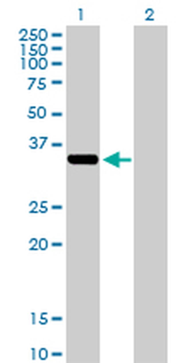 AKR1C2 Antibody in Western Blot (WB)