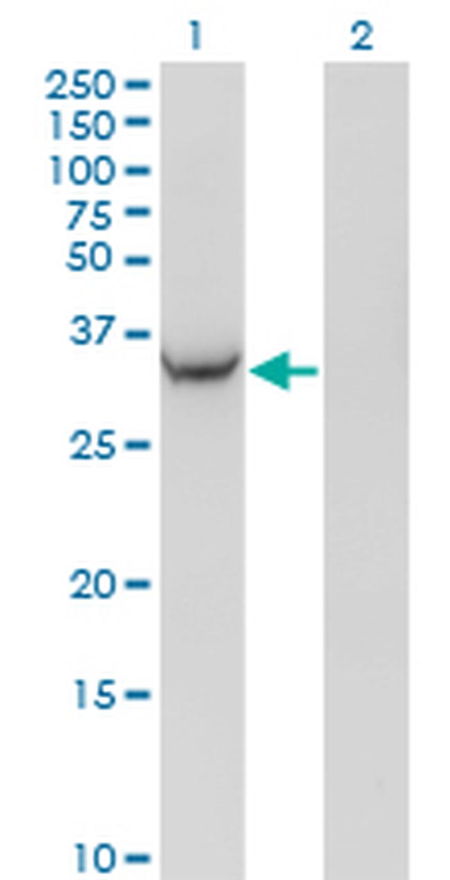 AKR1C2 Antibody in Western Blot (WB)