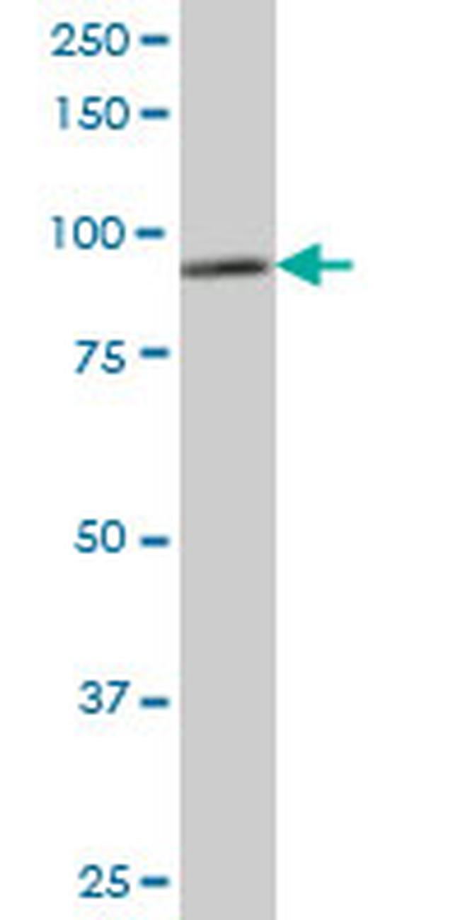 DDX1 Antibody in Western Blot (WB)