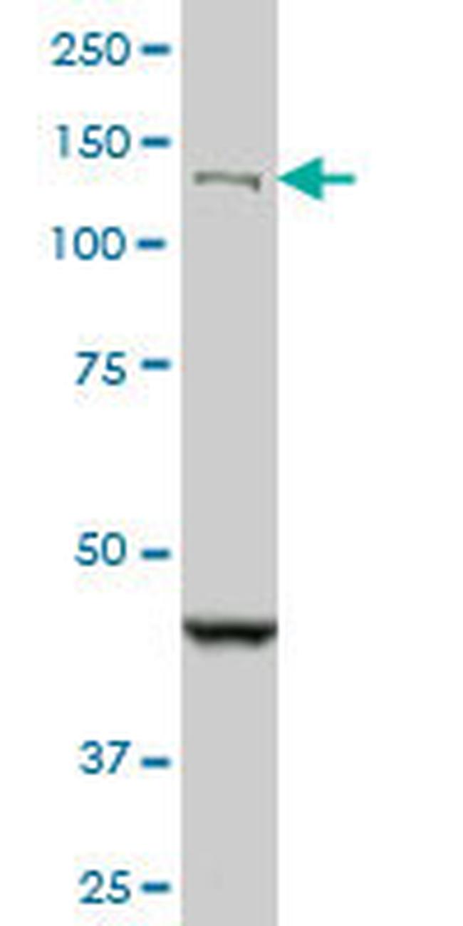 DHX8 Antibody in Western Blot (WB)