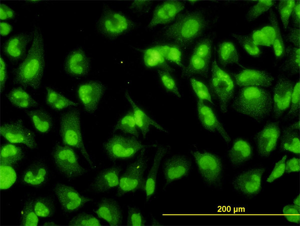 DHX9 Antibody in Immunocytochemistry (ICC/IF)