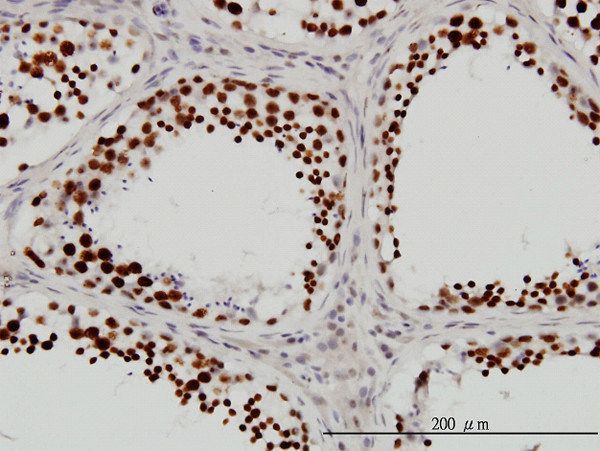 DHX9 Antibody in Immunohistochemistry (Paraffin) (IHC (P))