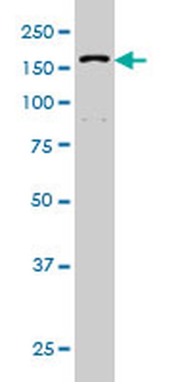 DHX9 Antibody in Western Blot (WB)