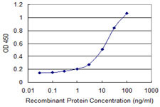 DECR1 Antibody in ELISA (ELISA)