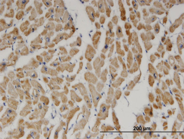 DECR1 Antibody in Immunohistochemistry (Paraffin) (IHC (P))