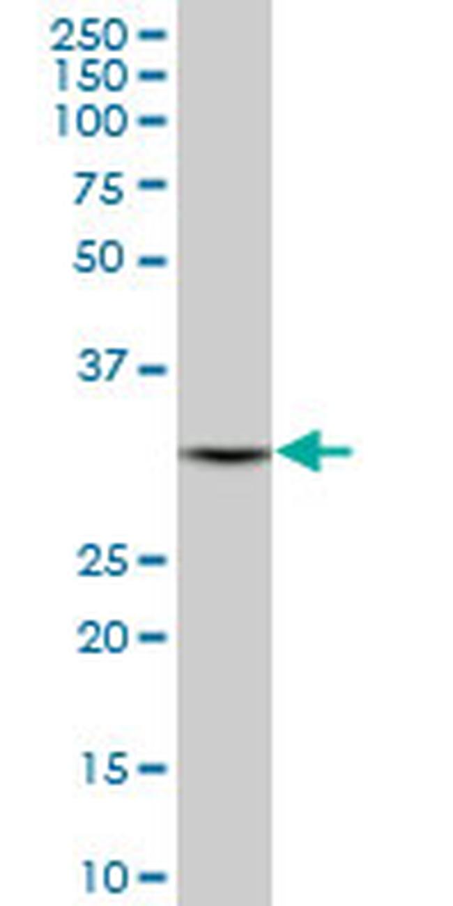 DECR1 Antibody in Western Blot (WB)