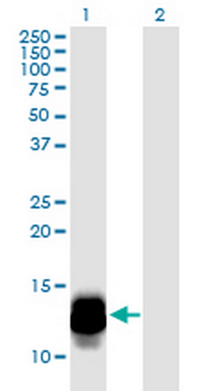 DEFA3 Antibody in Western Blot (WB)