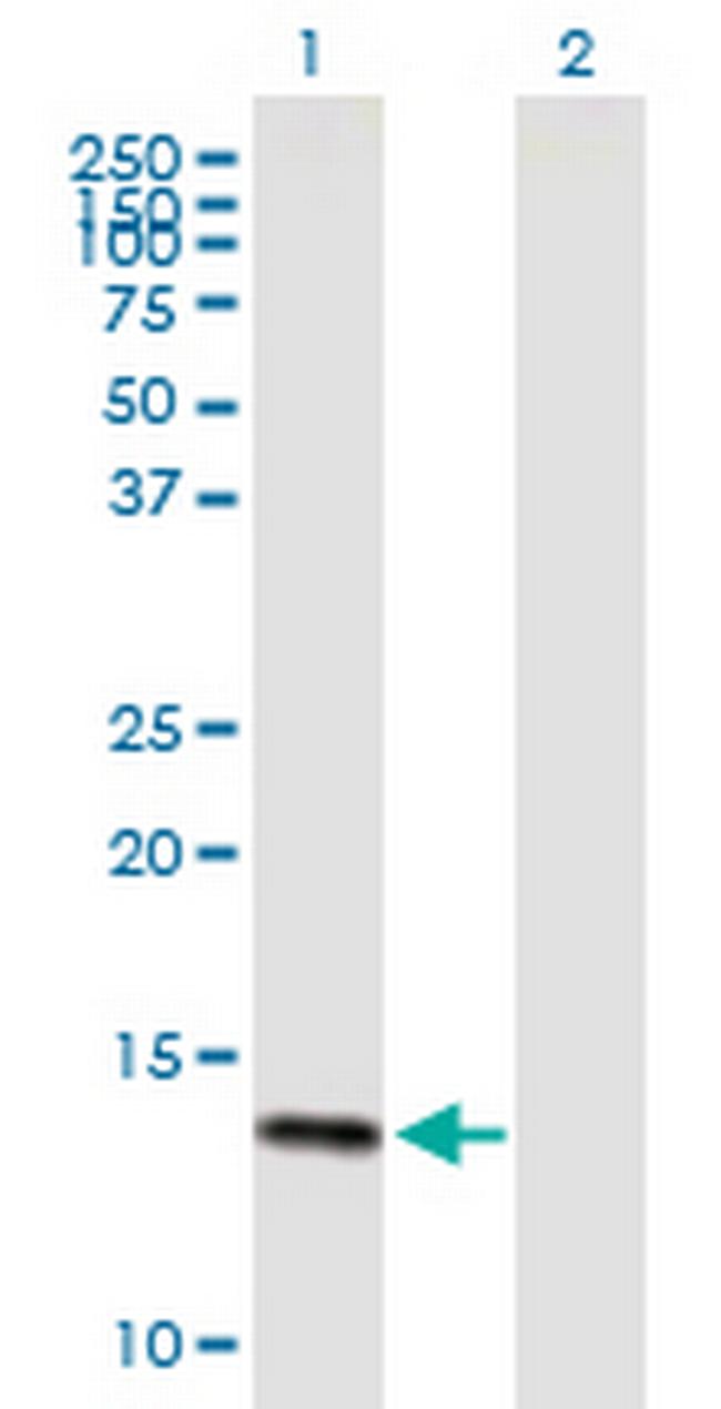 DEFA6 Antibody in Western Blot (WB)