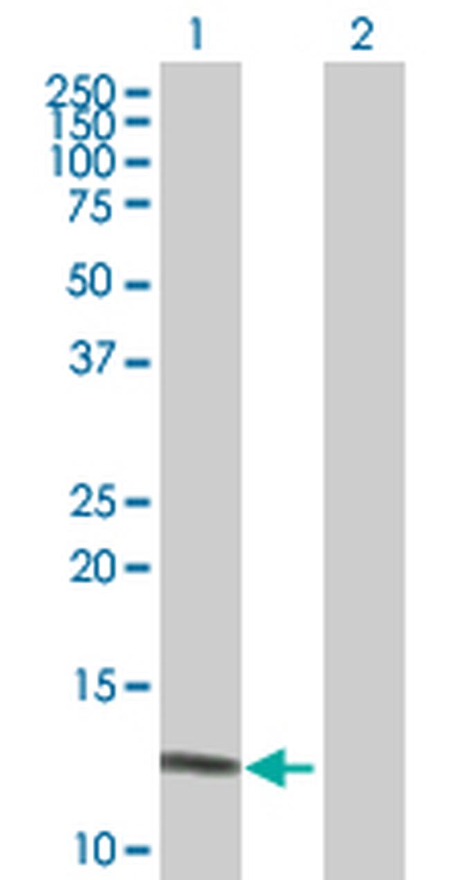 DEFA6 Antibody in Western Blot (WB)