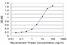 DES Antibody in ELISA (ELISA)