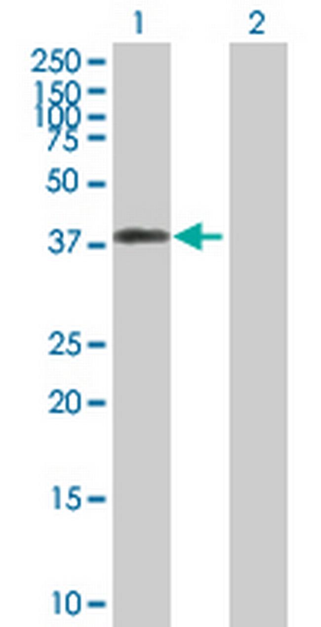 DFFA Antibody in Western Blot (WB)