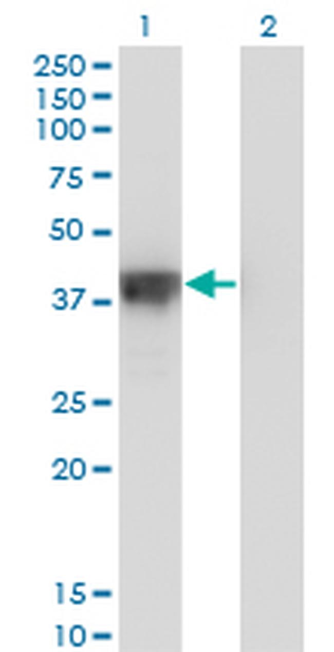 DFFA Antibody in Western Blot (WB)