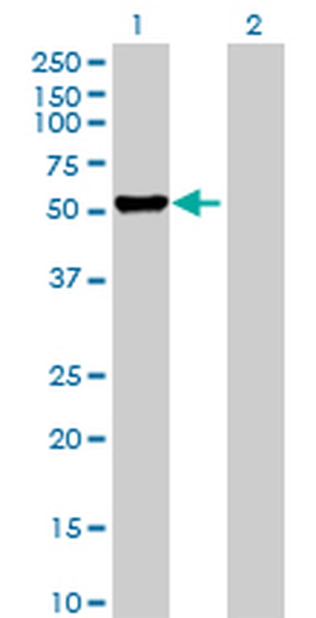 DFNA5 Antibody in Western Blot (WB)