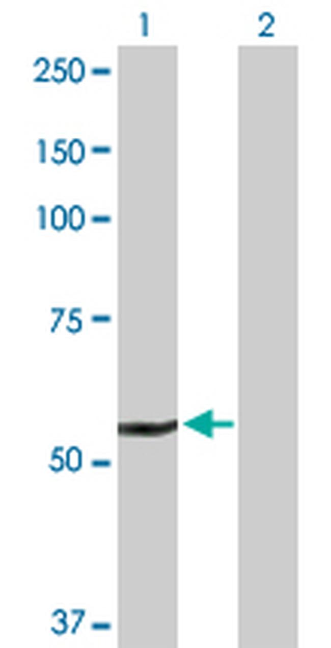 DHCR24 Antibody in Western Blot (WB)