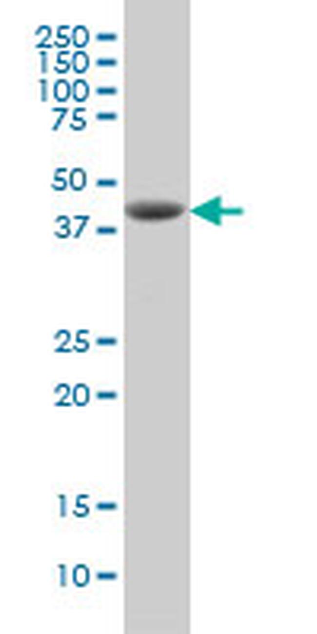 DHODH Antibody in Western Blot (WB)