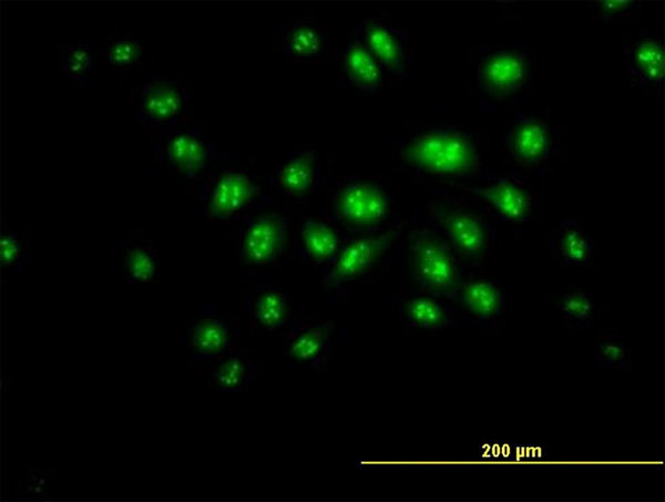 DKC1 Antibody in Immunocytochemistry (ICC/IF)