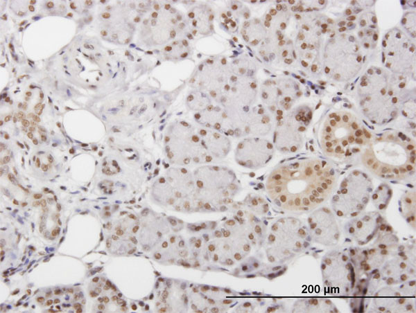 DKC1 Antibody in Immunohistochemistry (Paraffin) (IHC (P))