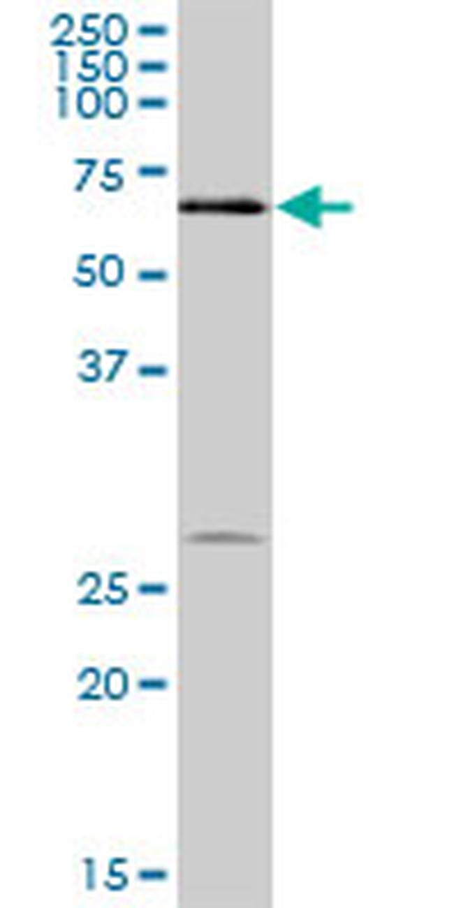 DKC1 Antibody in Western Blot (WB)