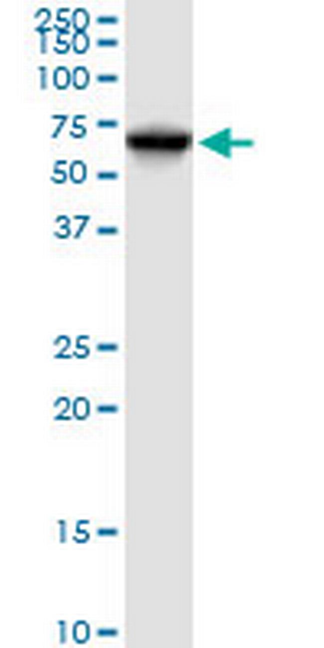 DLAT Antibody in Western Blot (WB)