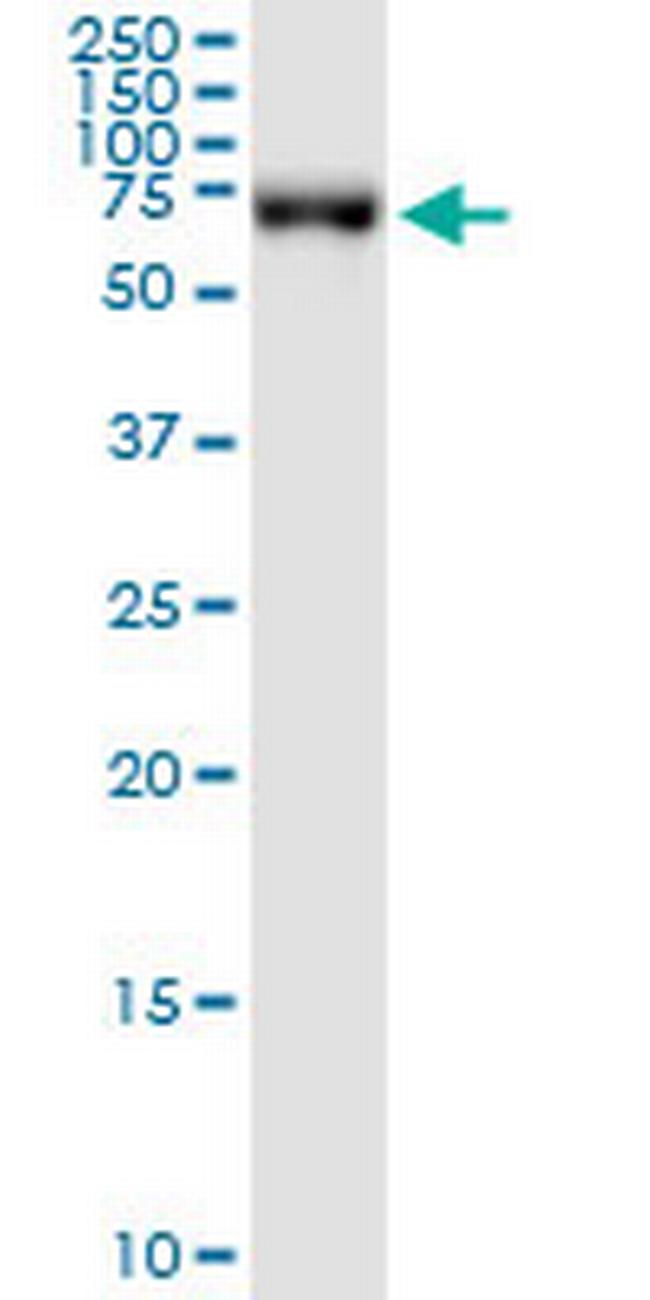 DLAT Antibody in Western Blot (WB)