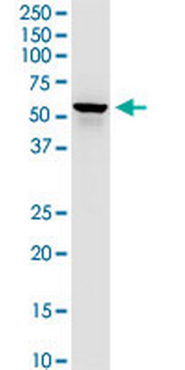 DLST Antibody in Western Blot (WB)