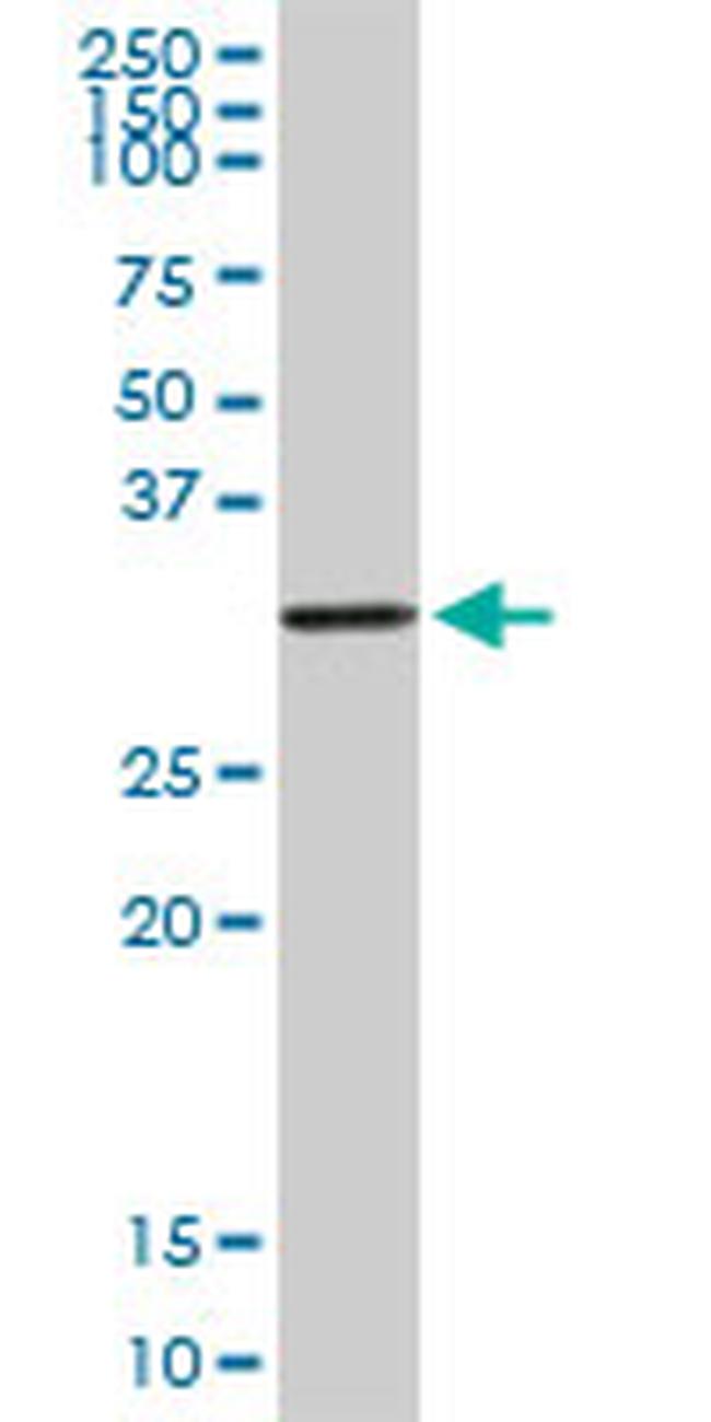 DLX1 Antibody in Western Blot (WB)