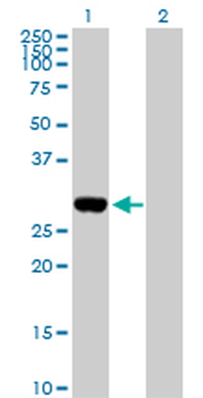 DLX1 Antibody in Western Blot (WB)