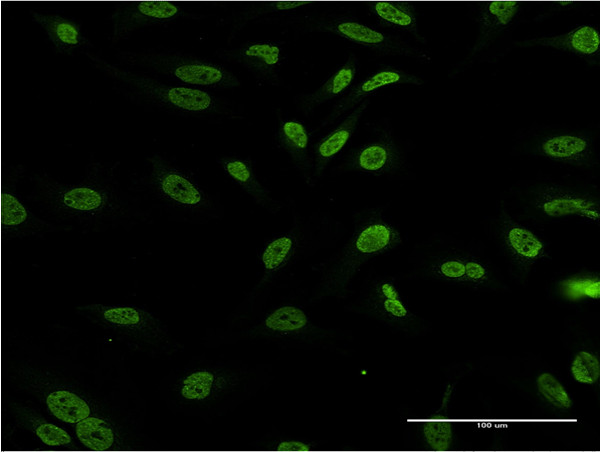 DLX1 Antibody in Immunocytochemistry (ICC/IF)